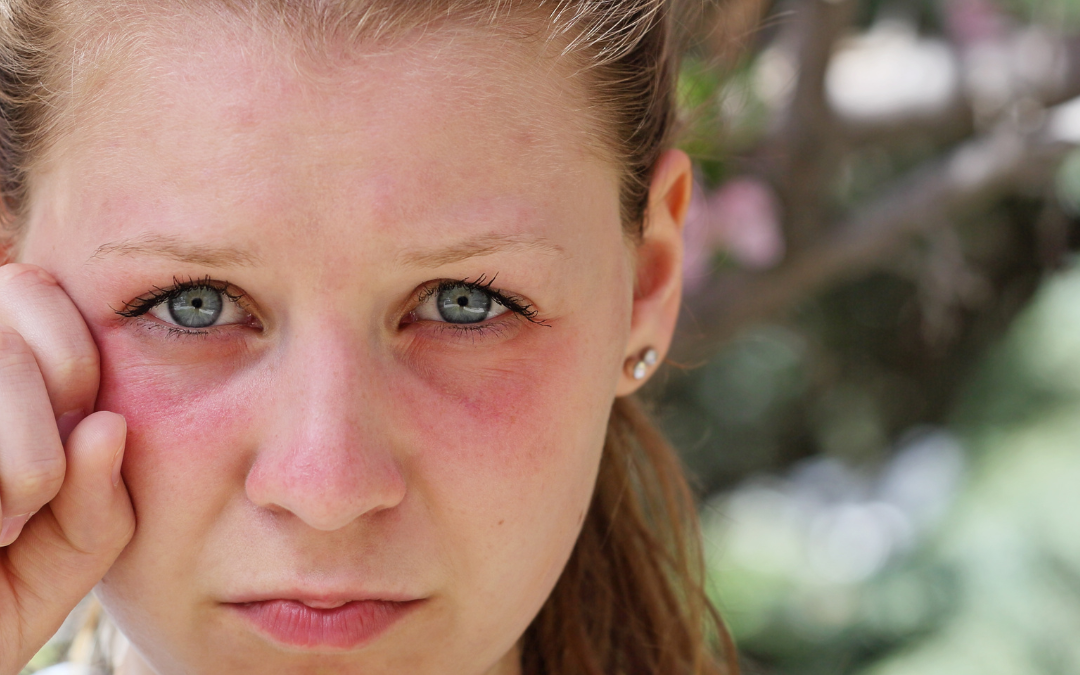 Spring, Allergies, and Sleep Quality